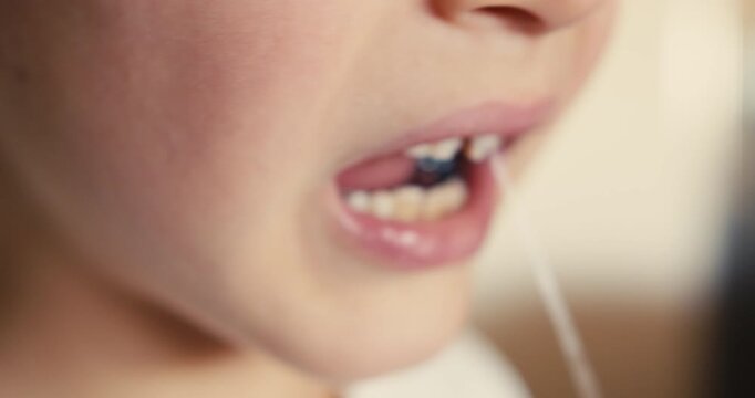Close-up of a boy mouth with a string tied to his front baby tooth, which he is moving with his thumb.