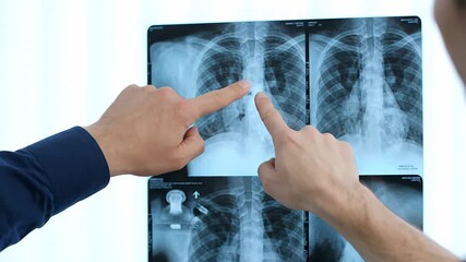 Medical professionals pointing at a chest x ray, discussing lung anatomy and possible disease findings during a clinical diagnostic consultation in a medical office - Powered by Adobe