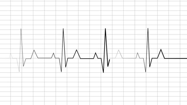 Heartbeat and pulse rate signal neon colorful technology animation on grid background. Electrocardiogram show heart beat line icon animated video on white background.