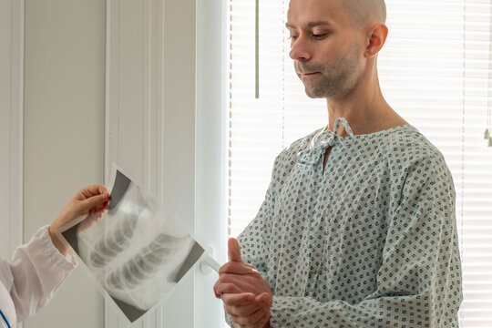 woman doctor holding and examining chest x ray bald male patient in hospital gown medical diagnosis and consultation, diagnostic imaging specialist examining chest scan detect, health issues