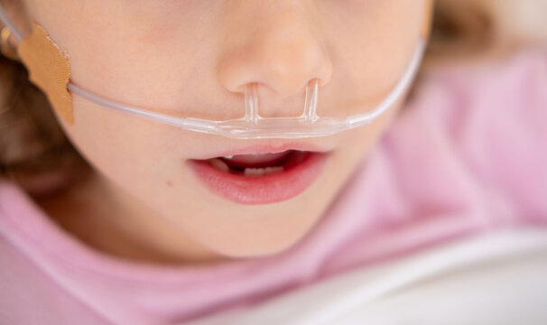 child lying with nasal cannula supplying oxygen, eyes closed, suggesting illness, recovery, or treatment for respiratory condition, Pediatric medical care, oxygen therapy via nasal cannula in hospital