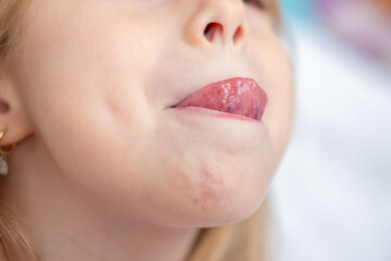 Fototapeta premium Child showing tongue, Young girl sticking out tongue, playful expression, tongue visible, speech therapy, pronunciation practice session, practicing sounds, oral anatomy health, dental tongue exercise