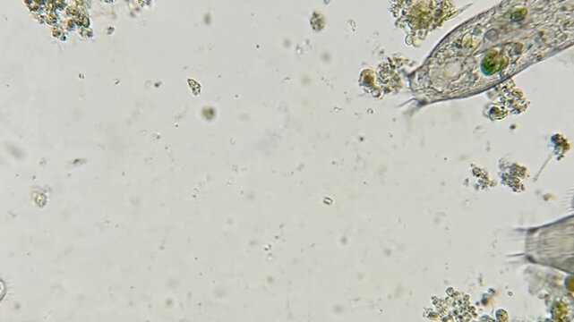 원형동물,짚신벌레,벌레,단세표,원생생물,protozoa, strawworms, worms, pedicures, protozoa