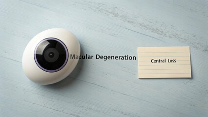 An eye model with label illustrating macular degeneration