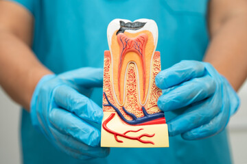 Asian dentist holding dental implant, artificial tooth roots into jaw, root canal of dental...