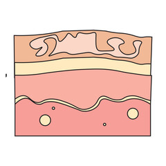 Tinea Versicolor Skin Disease