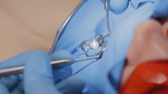 Dental procedure on young caucasian female with protective gear cofferdam and blue gloves.