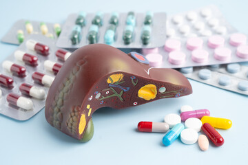 Liver model with pill drug treatment, Cirrhosis, Liver cancer, fatty liver.