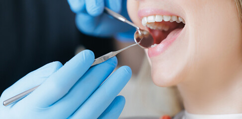 Professional oral caries treatment, Female caucasian adult receiving dental checkup with dentist using tools