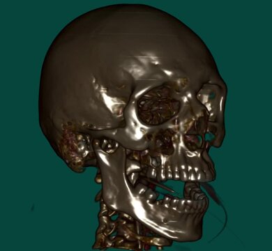 skull of war