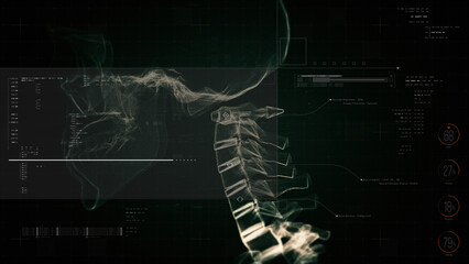 Biotech X-ray scan of lumbar spine with digital HUD diagnostics, vertebrae mapping, and futuristic medical interface elements for advanced anatomy visualization
