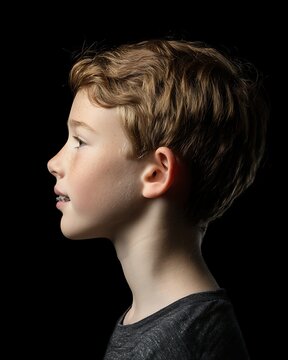 kid side profile before-after braces, overjet vs corrected bite