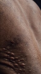 Fototapeta premium Close-up of dark skin with pores and raised bumps.