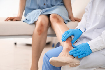 Obraz premium Female doctor examining patient's bruised legs on couch in clinic, closeup