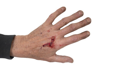 Realistic close-up of a hand with red injury stains on clean white background, PNG transparent format, high detail, useful for medical, safety, and accident concept designs.