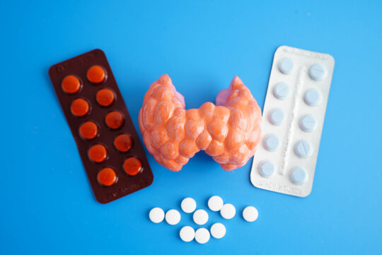 Thyroid model with pill drug treatment, Hyperthyroidism, Overactive or Lymphoma.