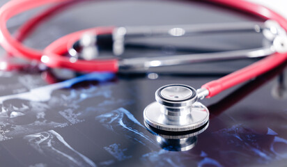 Red stethoscope on medical x-ray image: healthcare and diagnostics Closeup