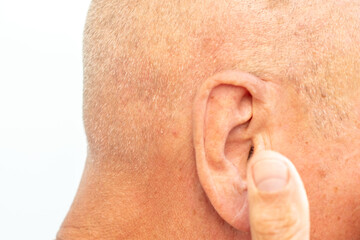 Close-up elderly man's ear, showing details aged skin, wrinkles, and potential presence hearing...