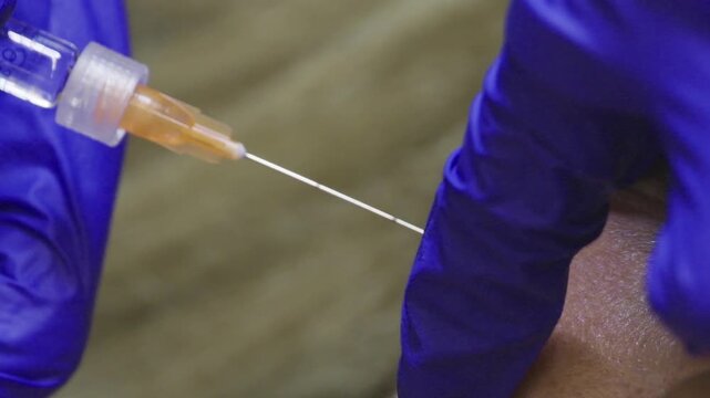 Aesthetic doctor performing pdo thread lifting procedure