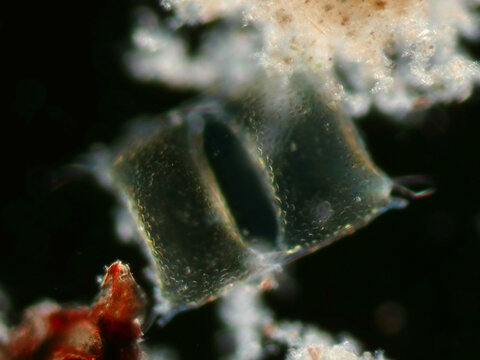 Trieres chinensis tripolar diatom under darkfield microscopy at 20x 0.50 NA &ndash; illuminated silica chamber with high-contrast structural detail