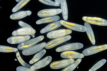 Clinostomum spp. are freshwater flukes with a worldwide distribution and a complex life cycle...
