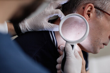 Middle aged Caucasian man undergoing skin examination by medical professional wearing gloves, dermatologist using magnifying glass to inspect mole on neck during patient visit