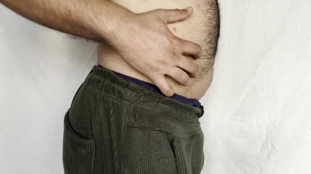 Man with an aggressive form of hives, nettle rash on back. Man with inflamed ear on white background scratching skin. Red, itchy welts common in men's allergic skin reactions.