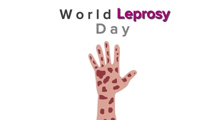 World Leprosy Day awareness campaign graphic, showcasing a human hand with visible skin lesions to symbolize the disease and advocate for global health initiatives