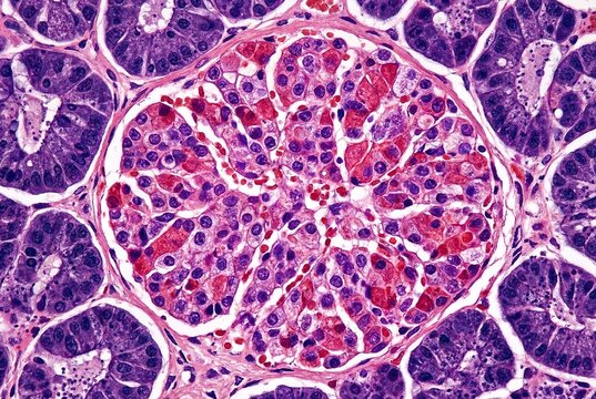 Micrograph of a pancreatic islet, showing endocrine cells of Langerhans surrounded by exocrine pancreatic acini, highlighting cellular structure.. Histology concept