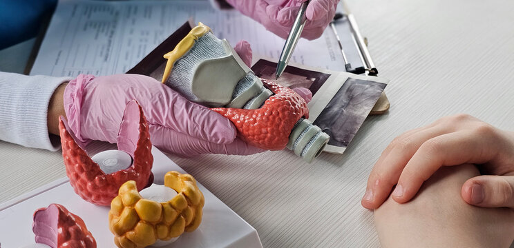 Doctor demonstrating thyroid anatomy using models during a patient consultation