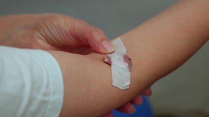 A bandage is already applied to the elbow crease. After the injection, blood is visible on the surface. The person is touching the elbow with the other hand. Close-up shot."