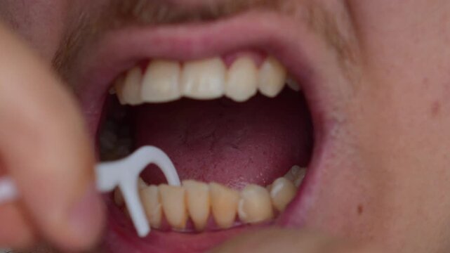 Food particles stuck in a man's teeth.
A man flossing between his teeth to eliminate bad breath.
Dental health and fresh breath
