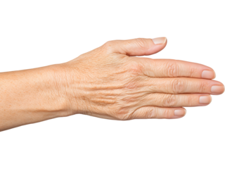 Close-up of a hand with dry cracked skin, isolated on transparent background, ideal for skincare ads, dermatology visuals, aging themes, and medical design projects..