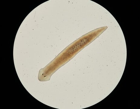Microscopic view of a Planaria flatworm specimen