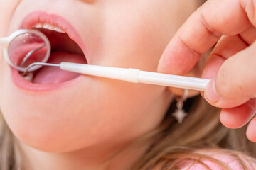 dentist, doctor examines oral cavity of small patient, uses mouth mirror, closeup baby teeth child,...