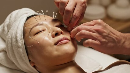 Acupuncture treatment on a womans face for relaxation and health.