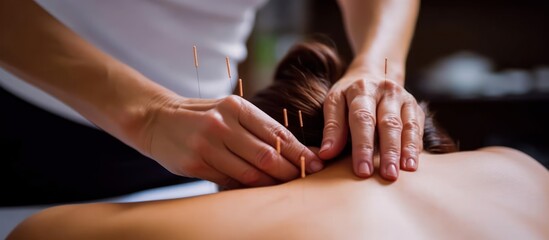 Close-up of hands performing acupuncture on a persons back.