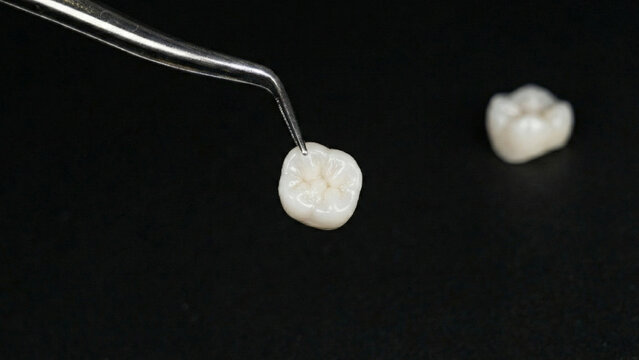 Macro close-up of a ceramic dental crown held by tweezers, isolated on black background with another tooth in the background.