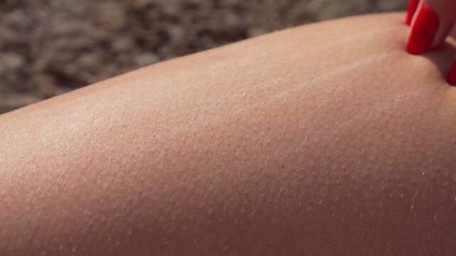Woman skin goosebumps, hand with red nails touching a leg, showing a reaction to cold or sensation in close-up detail.