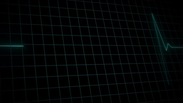 EKG Heart Monitoring Endless loop animation on black background. Full HD. 4K