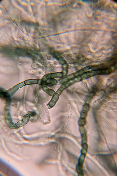 A high-magnification micrograph showing chains of dark, barrel-shaped fungal arthroconidia or chlamydospores arising from septate, pigmented hyphae, indicative of certain molds