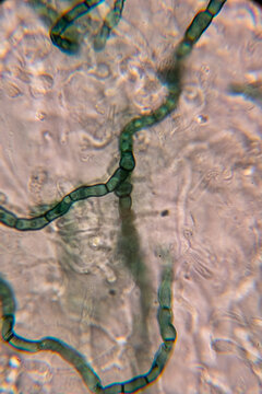 A high-magnification micrograph showing chains of dark, barrel-shaped fungal arthroconidia or chlamydospores arising from septate, pigmented hyphae, indicative of certain molds