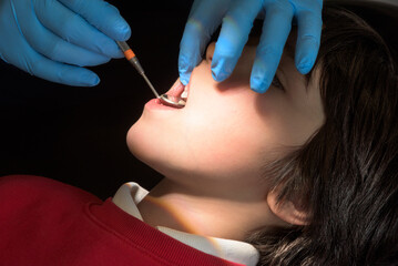 Children dental health. Child at dental clinic. Dentist's hands in blue gloves examining boy's teeth in dental office. Dentistry check up. Pediatric dentist with dental mirror in patient's open mouth.