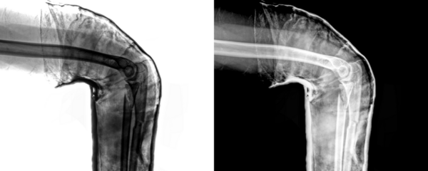 Elbow Lateral View X-Ray Radiograph Showing Detailed Bone Alignment and Joint Structure for Accurate Diagnosis of Elbow Fractures and Traumatic Injuries Isolated on Transparen