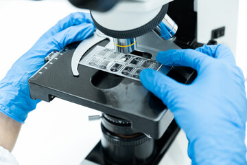 Selective focus technician working  and urine exam plate with microscope for scientist diagnosis at  laboratory department in the hospital.Medical analysis concept.