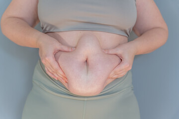 Woman holding belly fat with both hands, loose skin and abdominal fat close-up