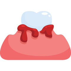 Stylized Vector Illustration of a Tooth with Bleeding Gums on a Transparent Background Simple Cartoon Dental Health Concept