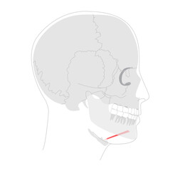 Geniohyoid - Muscle depicted in diagram connecting mandible to hyoid, functions in elevating hyoid and tongue, essential for swallowing, medical and educational tool