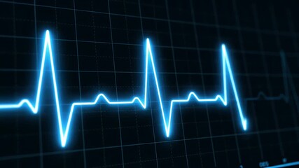 Close up of a glowing blue electrocardiogram ecg heartbeat line graph displayed on a dark monitor screen with grid - Powered by Adobe