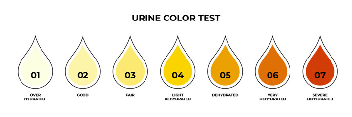 Urine color test with pee drops. Vector design for medical education about hydration and dehydration levels